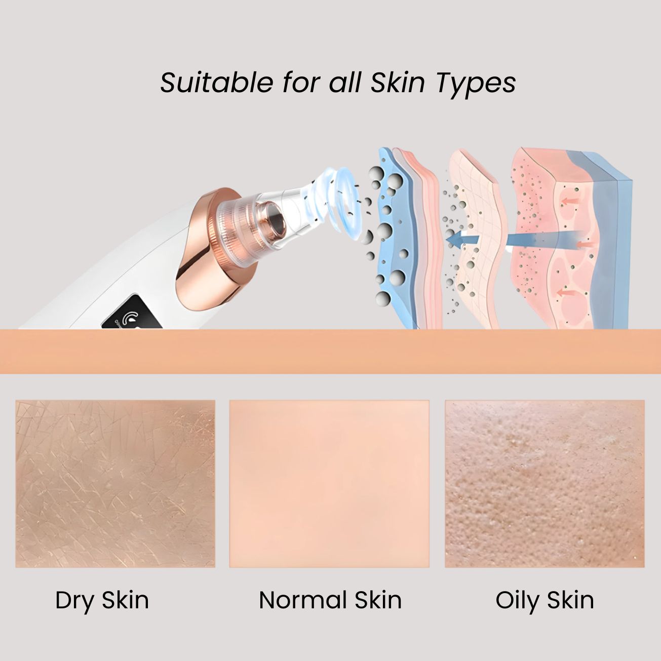 Blackhead Remover - Luluat