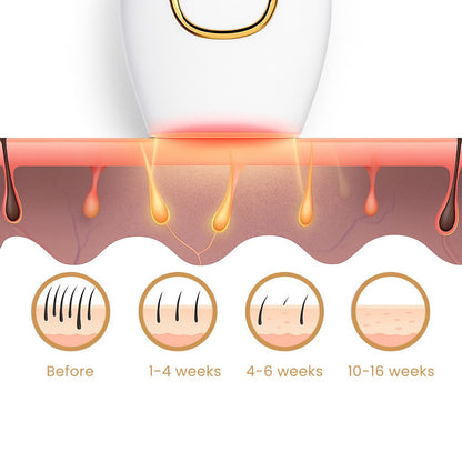 IPL Hair Remover - Luluat